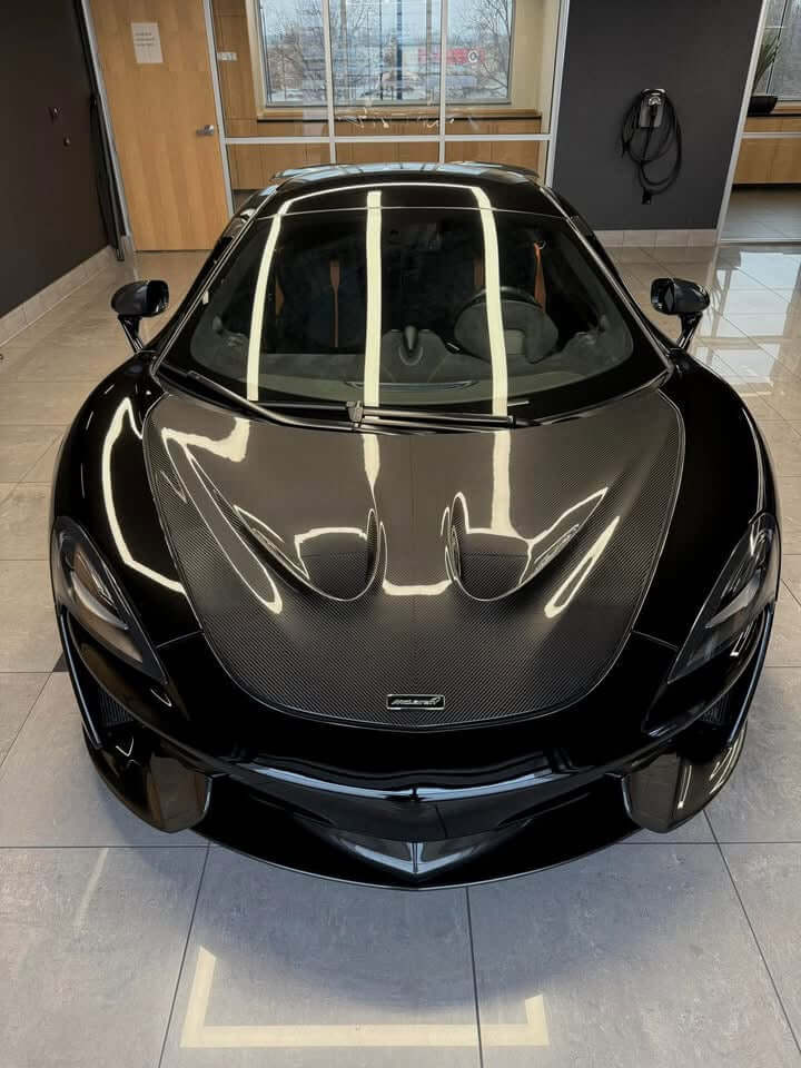 P1 Style Carbon Fiber Vented Hood Bonnet - McLaren 570s/570GT/540C/600LT.